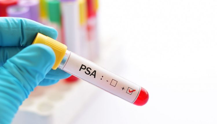 Prefeitura faz coleta de sangue para exame PSA em homens com 40 anos ou mais
